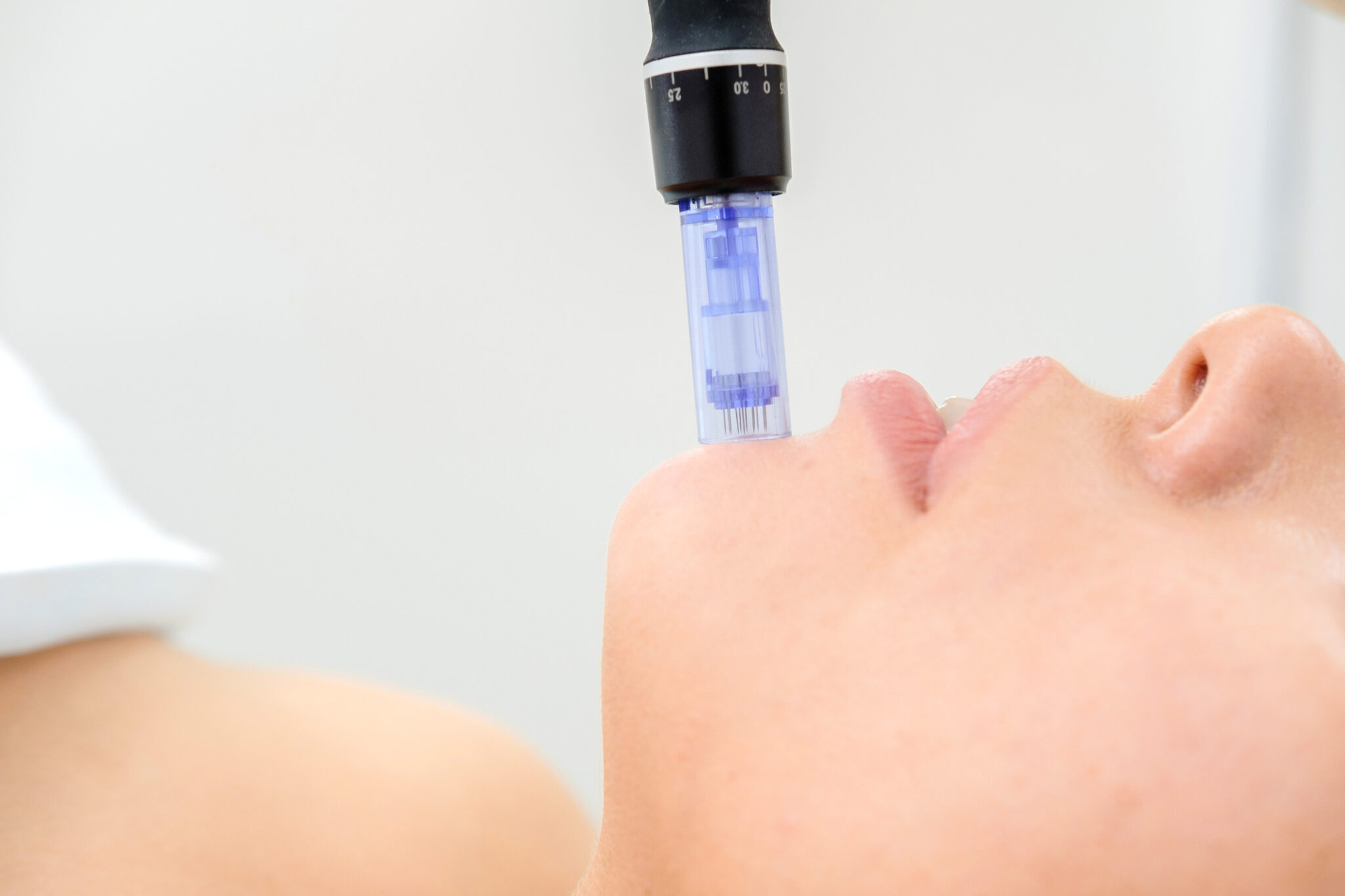 skin treatments leicester