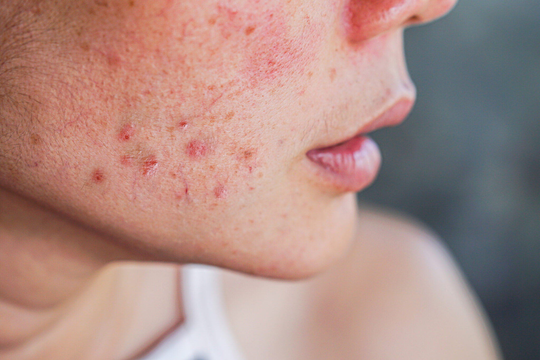 skin treatments leicester