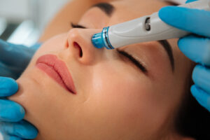 skin treatments leicester