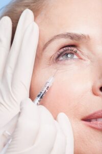 Section Tear Trough Filler