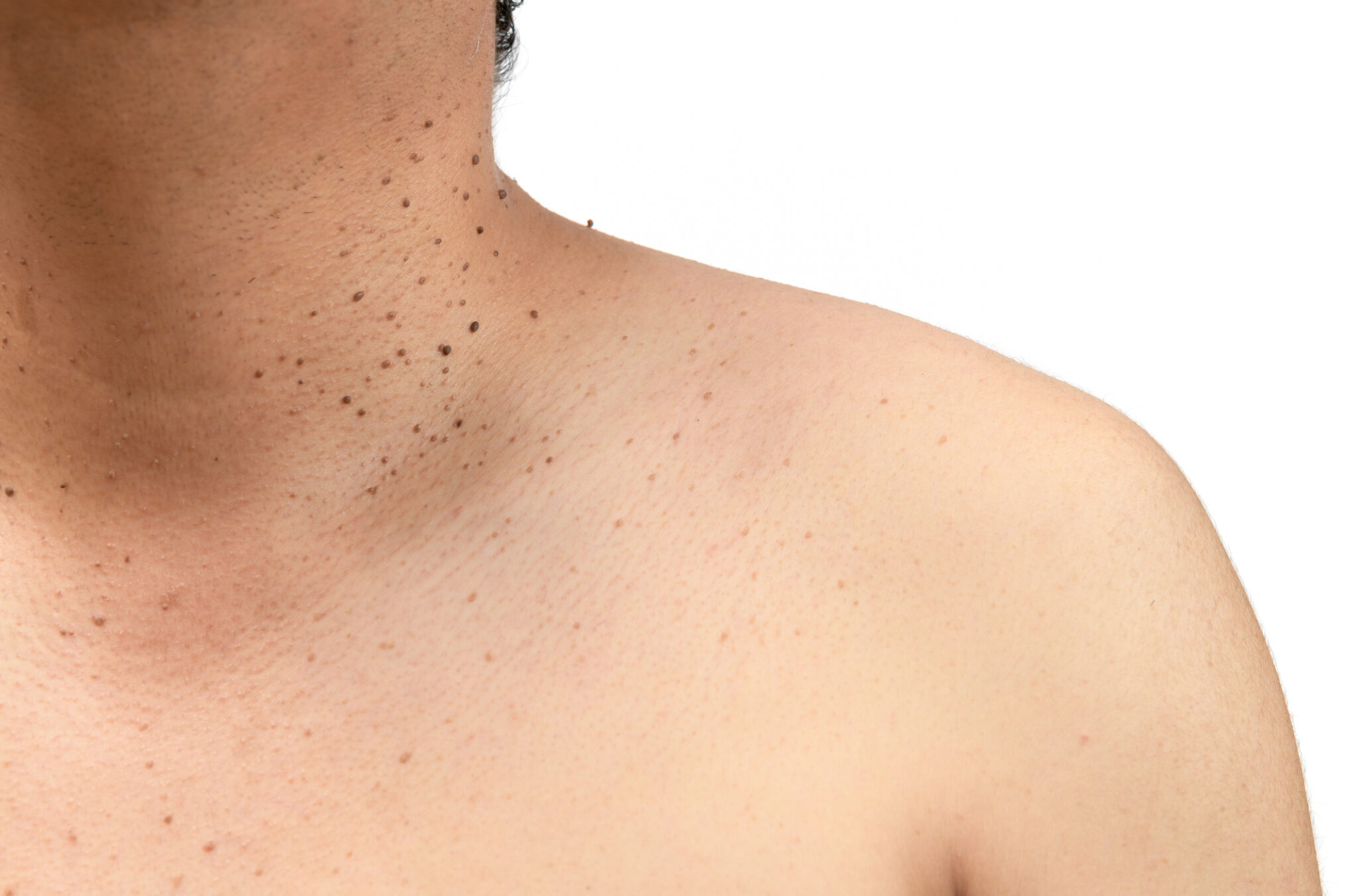skin treatments leicester