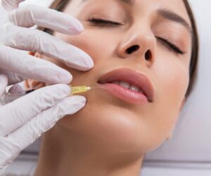 lip fillers leicester