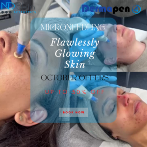 How Long Does Microneedling Last