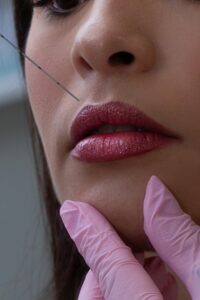 Do Lip Fillers Hurt