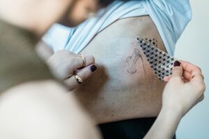 How Many Sessions to Remove a Tattoo
