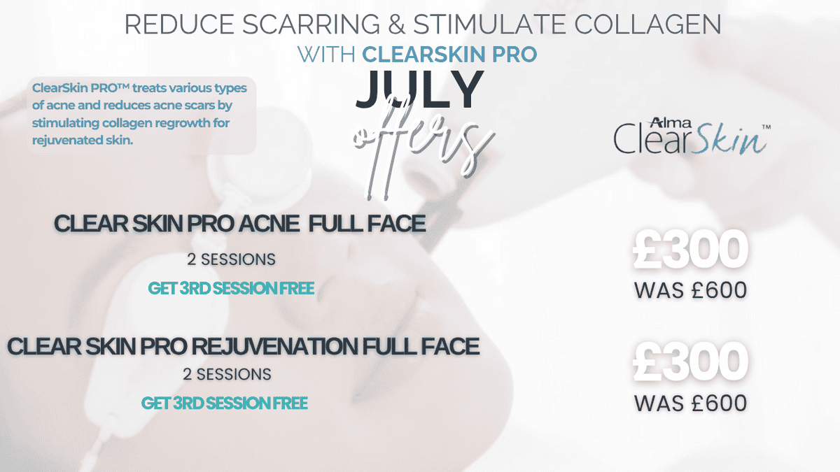 July skin treatment offer in Leicester – ClearSkin Pro acne and rejuvenation treatment, 2 sessions for £300, 3rd session free