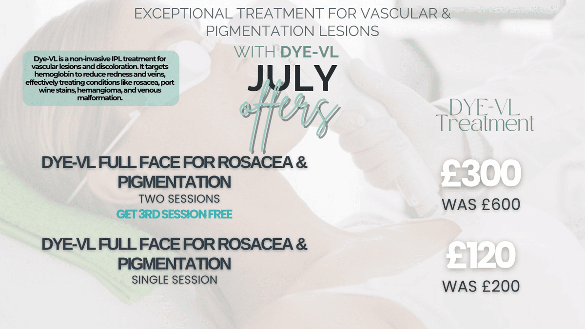 DYE-VL Treatment Leicester July Offer – 2 sessions for rosacea and pigmentation for £300, 1 session for £120