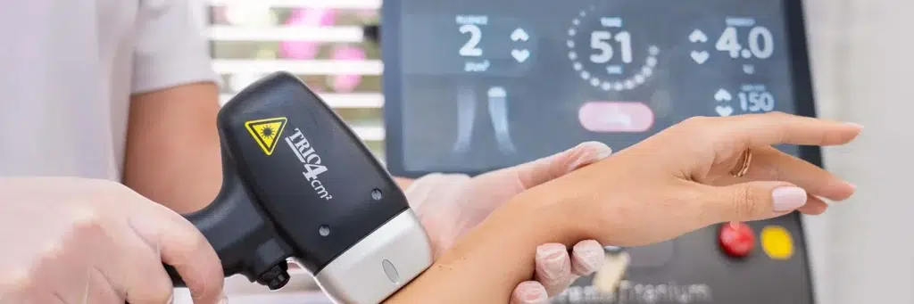  Laser Hair Removal on a Tattoo