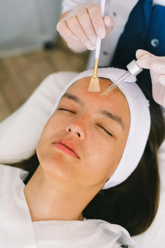 What Is a Chemical Peel