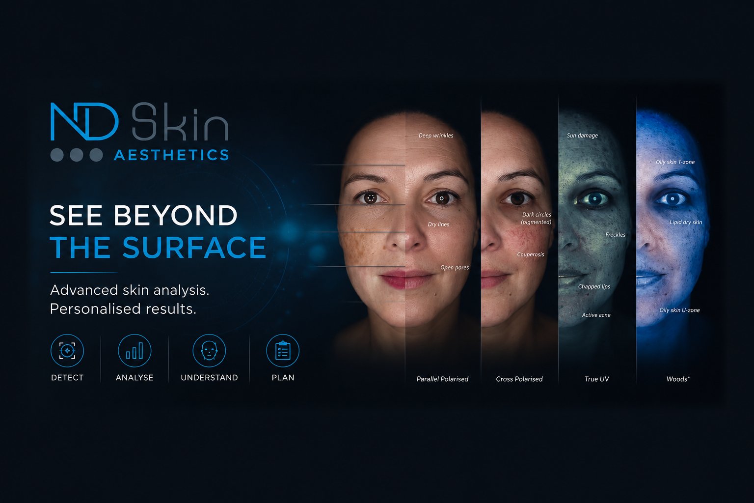 Facial skin analysis scan showing deep wrinkles, dark circles, sun damage and oily zones under different lighting modes